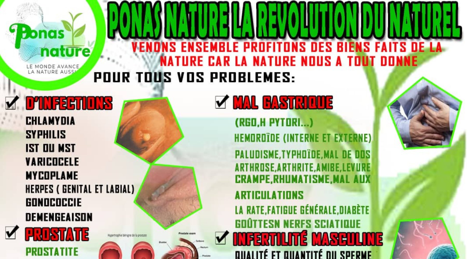 SANTE