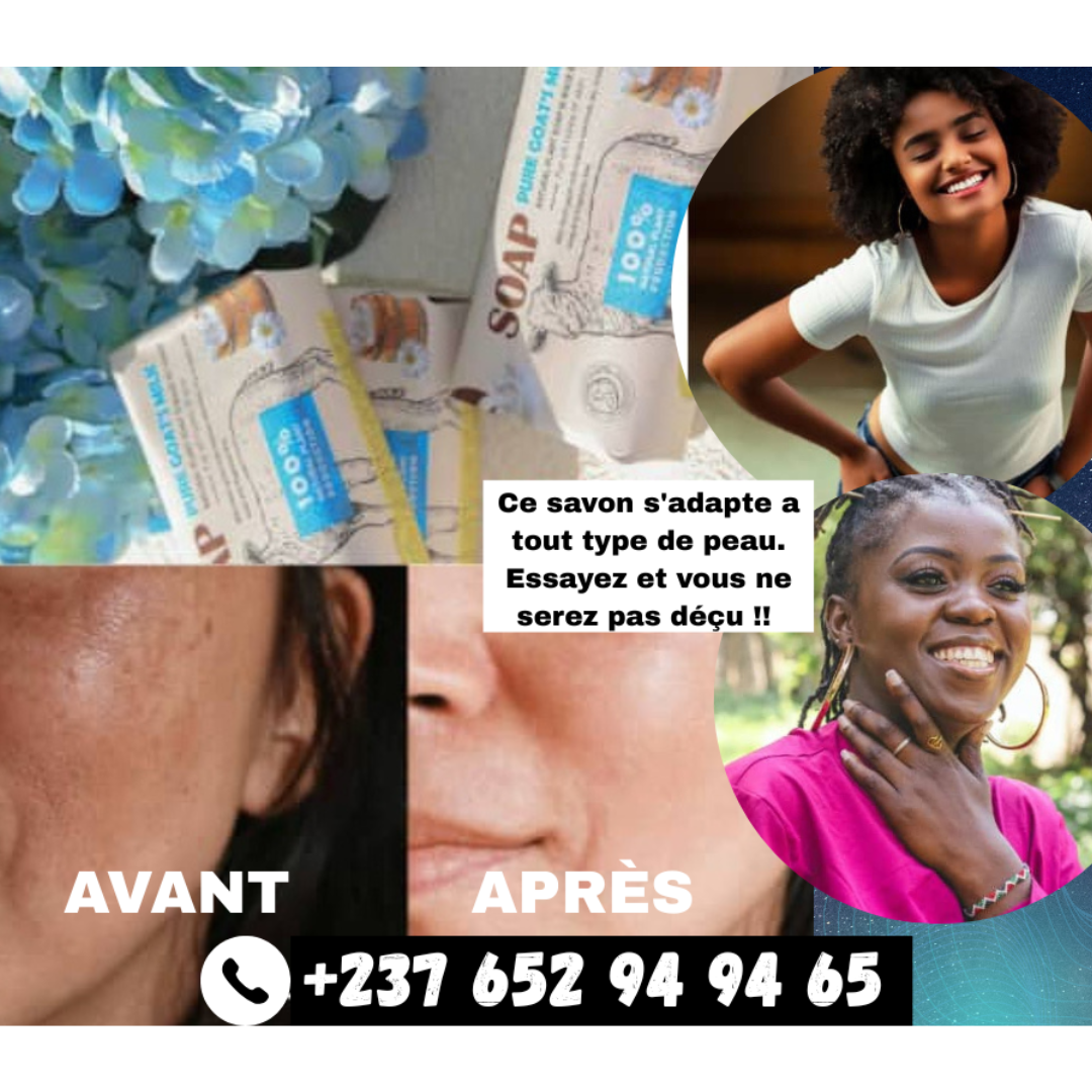 Savon Masque au Lait de Chèvre Frais Bio *2 Achetés + 1 OFFERT le tout a 13000f Idéal pour Eczéma, Psoriasis, Acné, Hydratant, Apaisant pour une Peau Douce et Éclatante