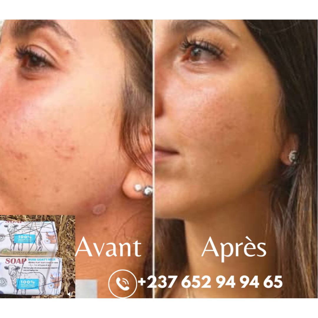 Savon Masque au Lait de Chèvre Frais Bio *2 Achetés + 1 OFFERT le tout a 13000f Idéal pour Eczéma, Psoriasis, Acné, Hydratant, Apaisant pour une Peau Douce et Éclatante